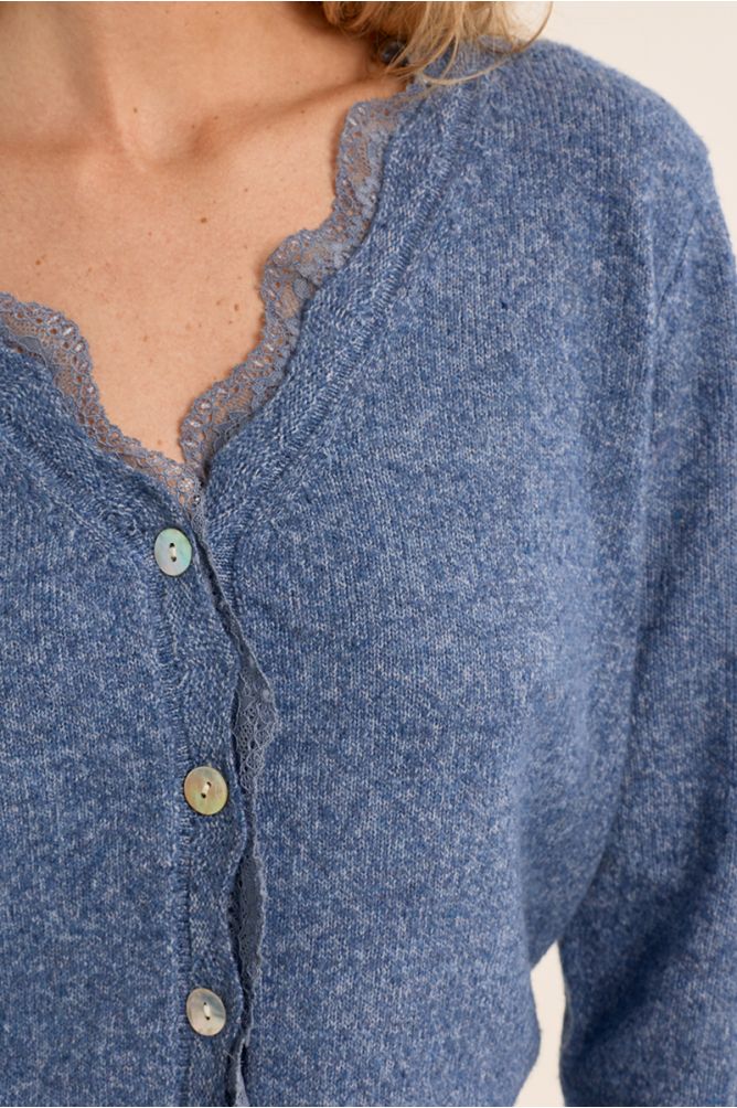 Lace scalloped cardigan